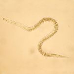 Beneficial Nematodes - Natural Pest Control